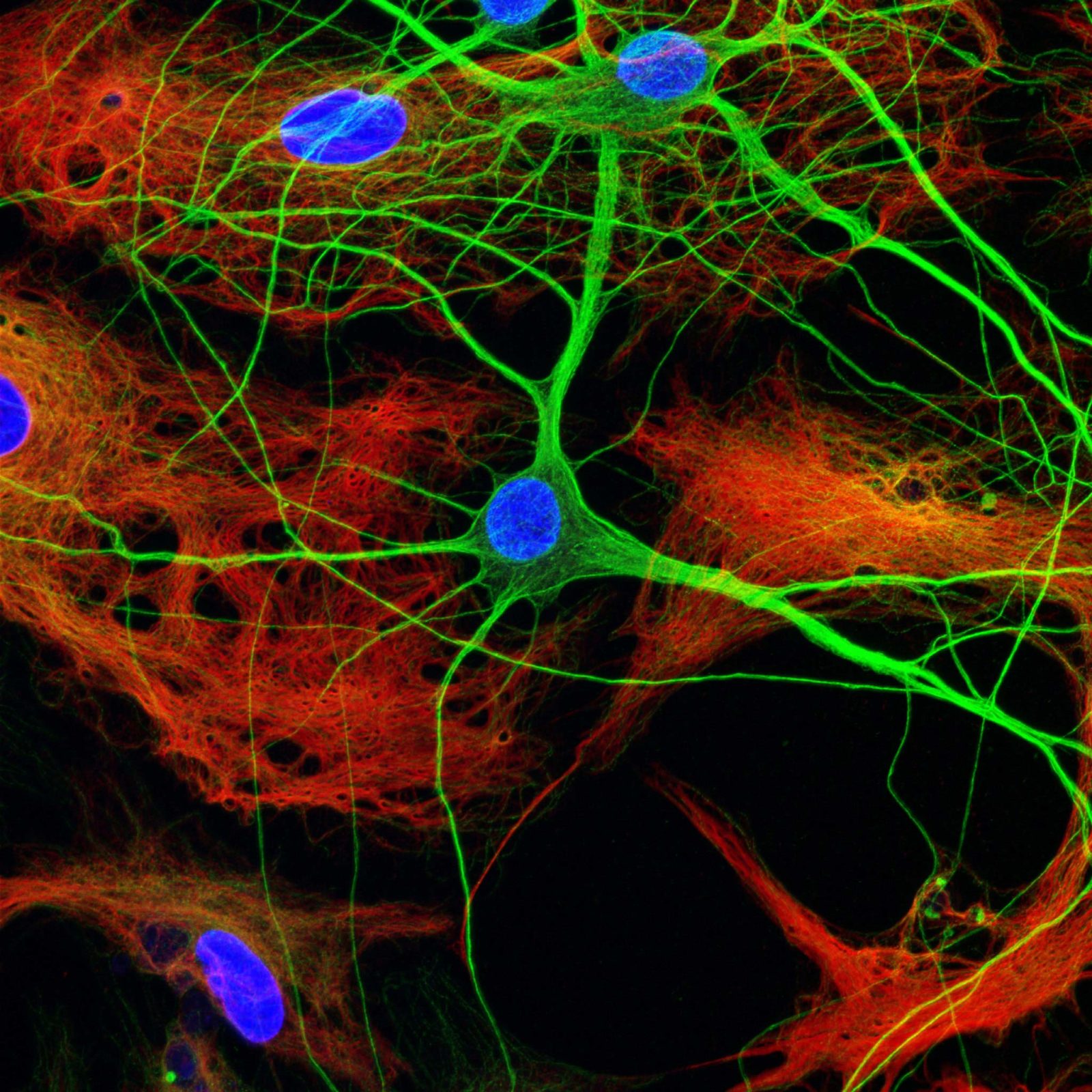 Primary Rat Hippocampal Neurons Nikon Small World