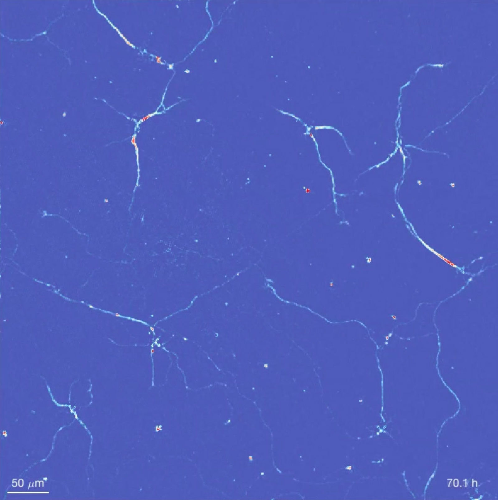 Day Time Lapse Of Rat Hippocampal Neurons Showing Development Of