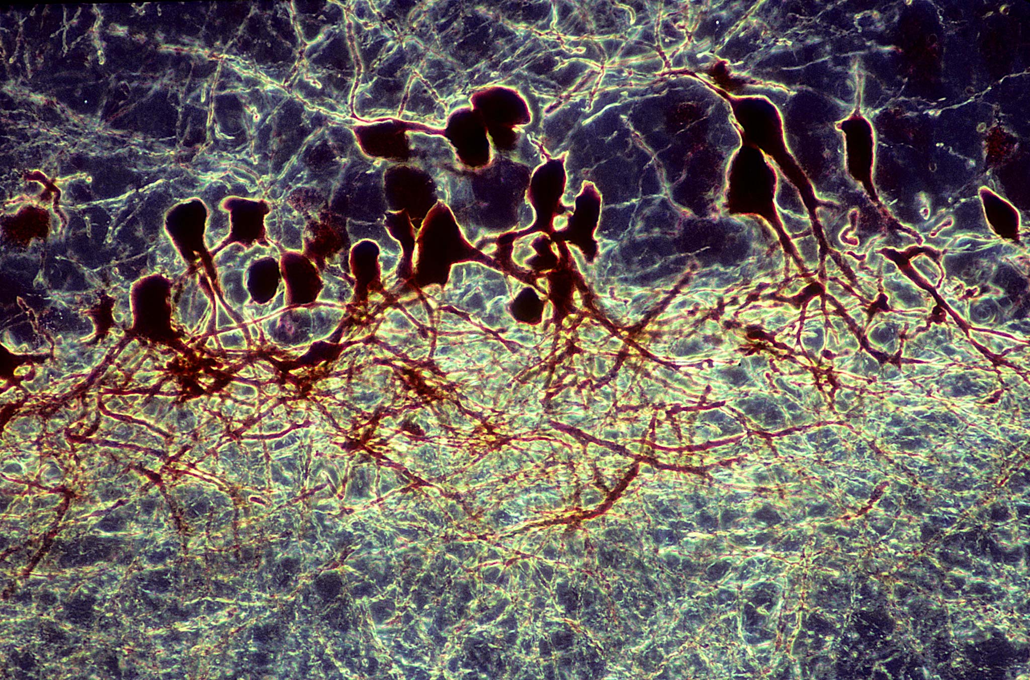 Cell bodies and dendritic arborizations of ventral horn neurons in frog ...