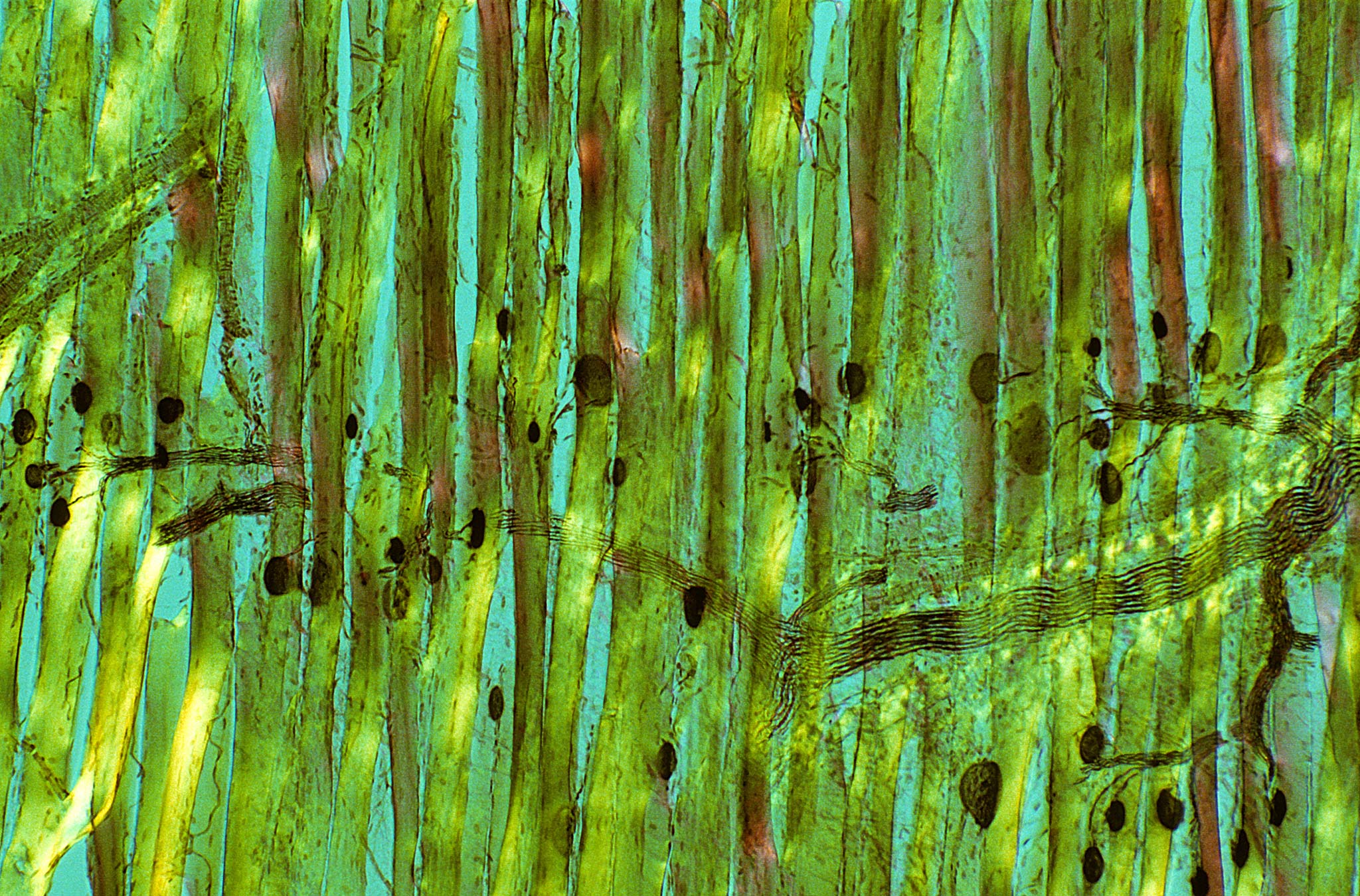 Medial gastrocnemius muscle in a rat | Nikon’s Small World