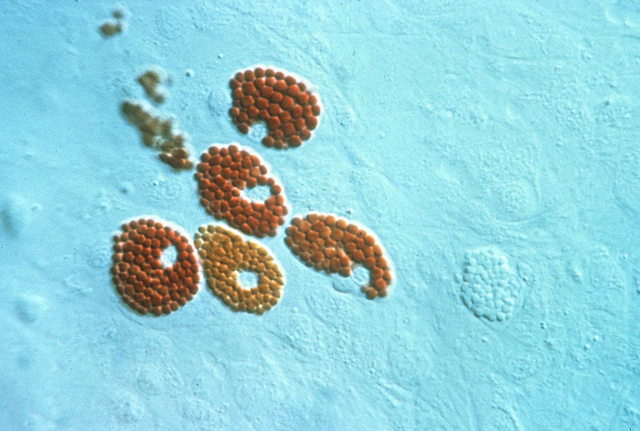 Red and white spherule cells, echinoderm coelomocytes (sea urchin blood ...