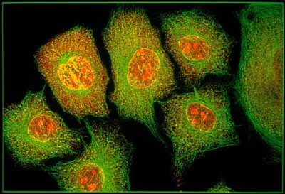 HeLa tissue culture cells | Nikon’s Small World