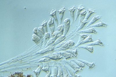 Living colony of Epistylis sp. | Nikon’s Small World