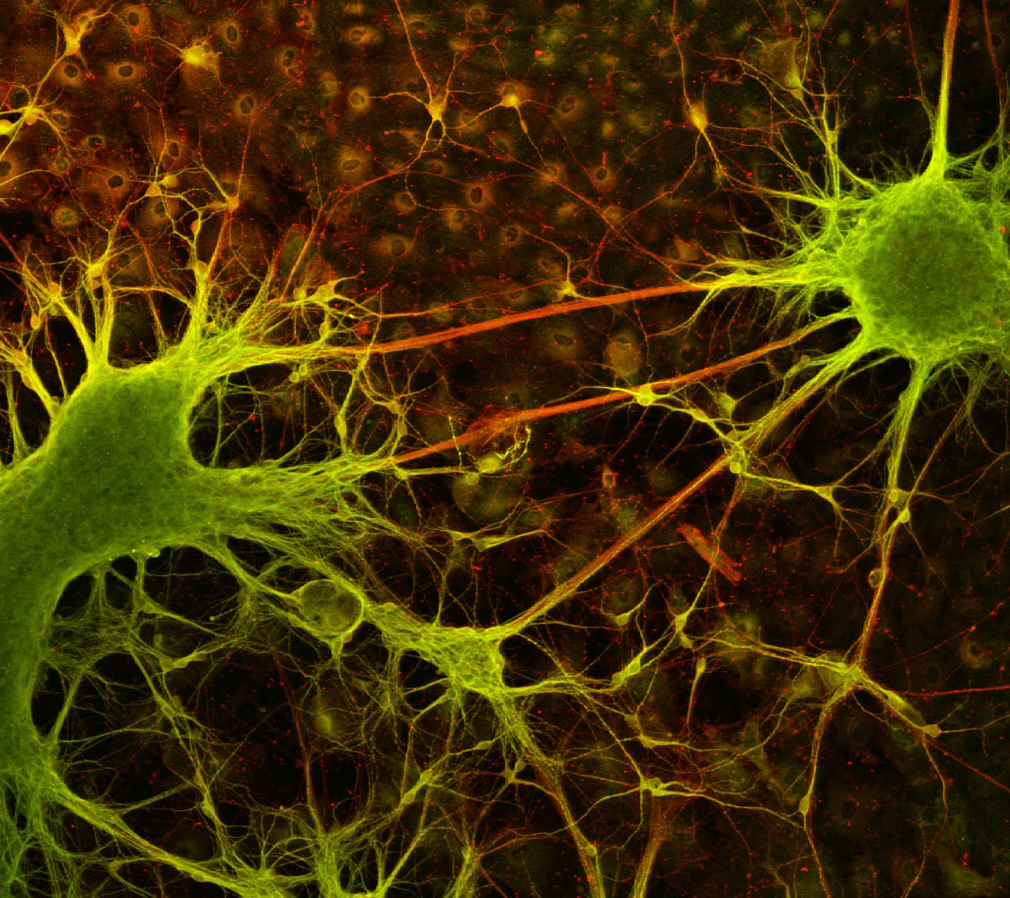 Differentiated human NT-2 neuronal cells, 6 weeks old | Nikon Small World