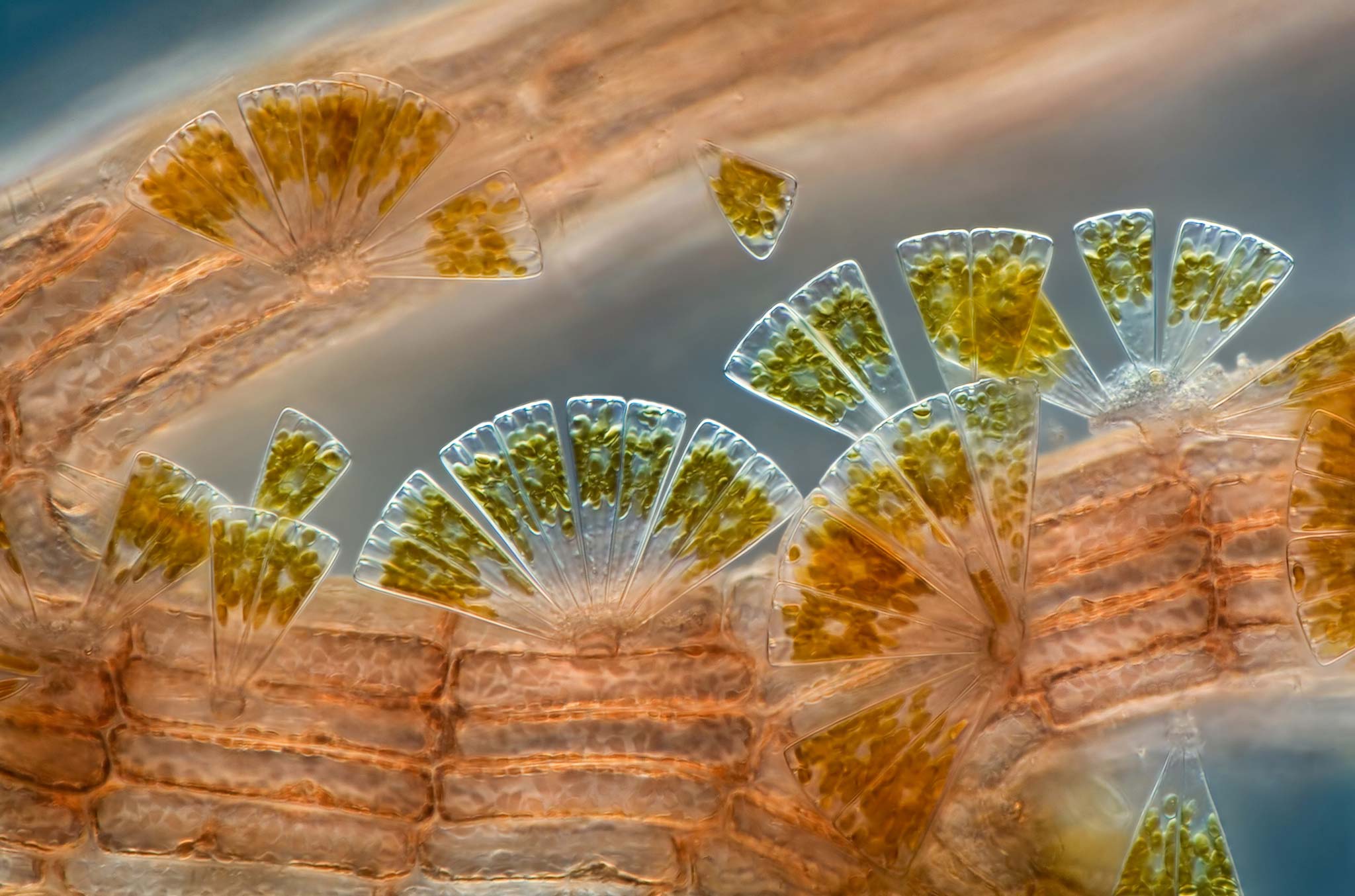 Marine diatoms attached to Polysiphonia (red algae) | Nikon’s Small World