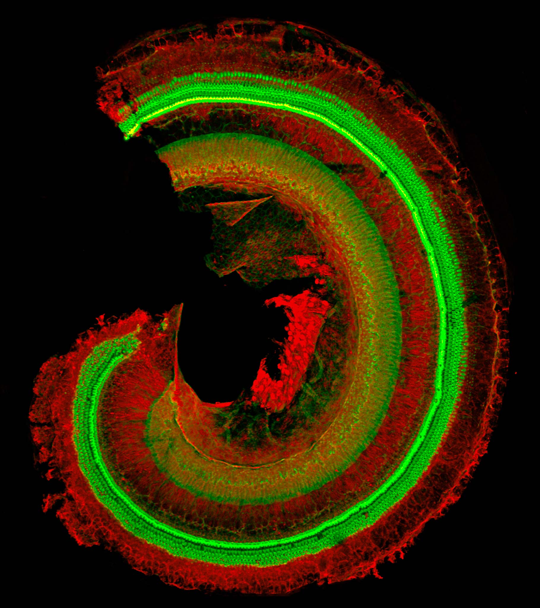 sound-receptor-hair-cells-bright-green-in-the-inner-ear-cochlea-of