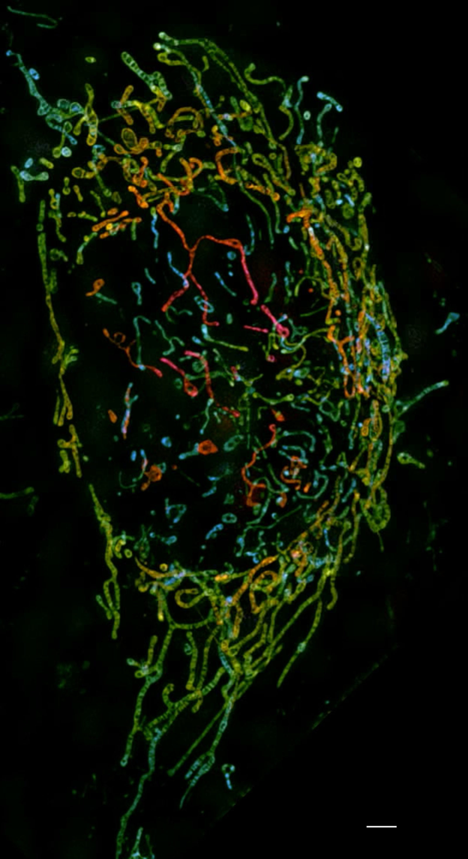 Structured Illumination Microscopy | Techniques | Nikon’s Small World