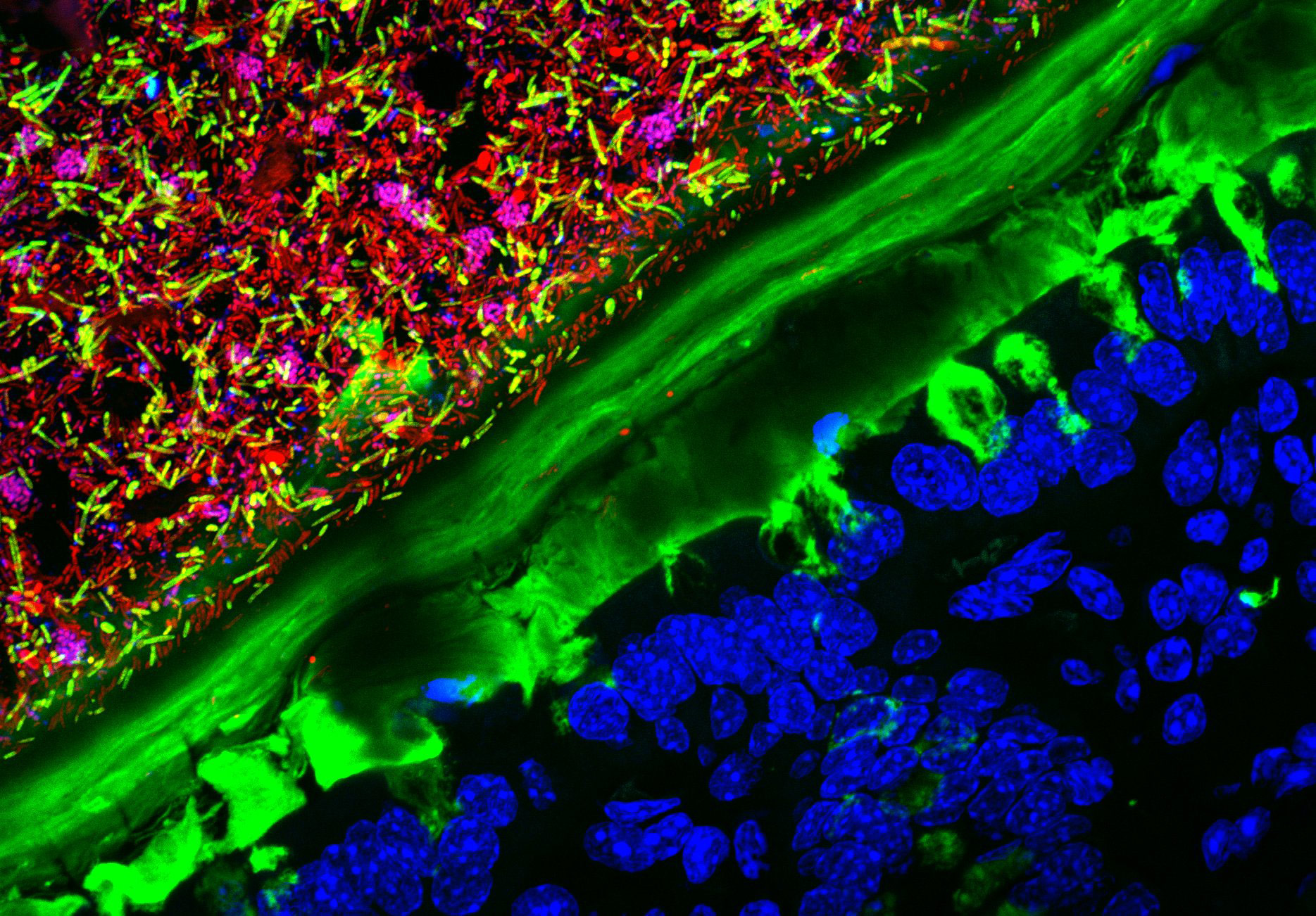 Mouse colon colonized with human microbiota | 2015 Photomicrography