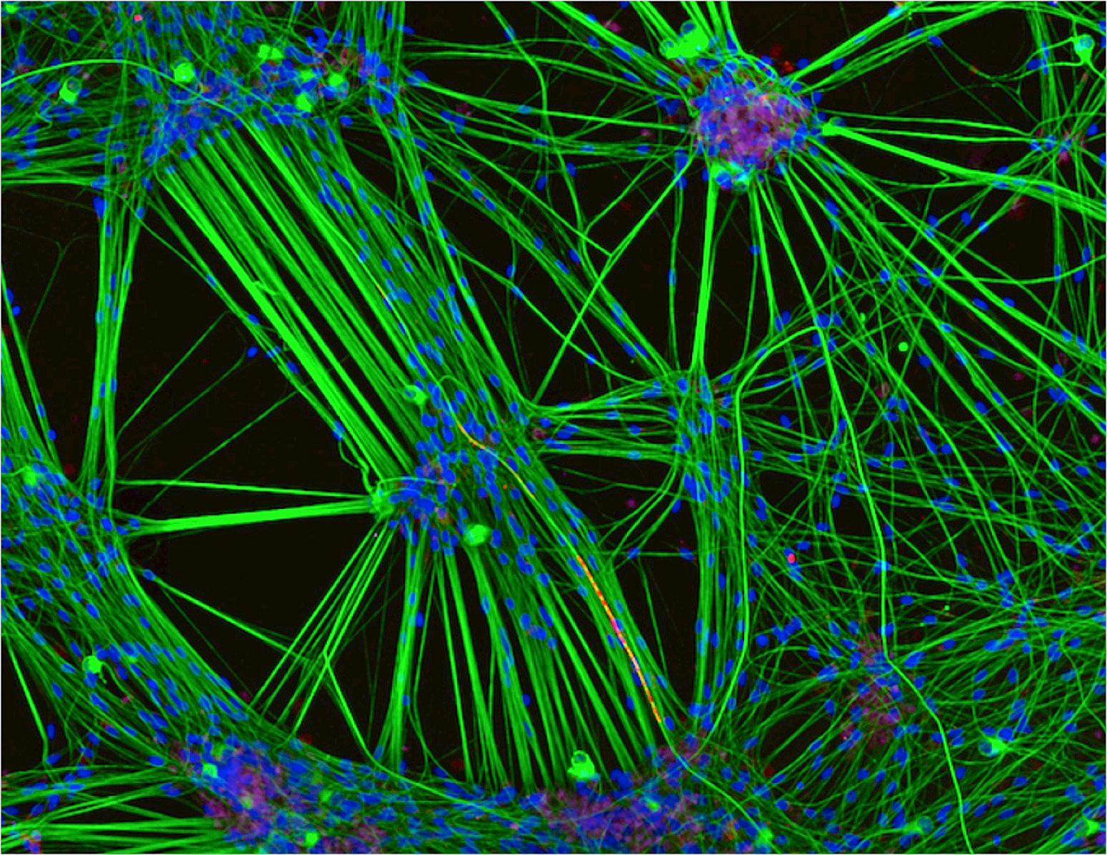 Culture Of Neurons Derived From Human Skin Cells And Schwann Cells