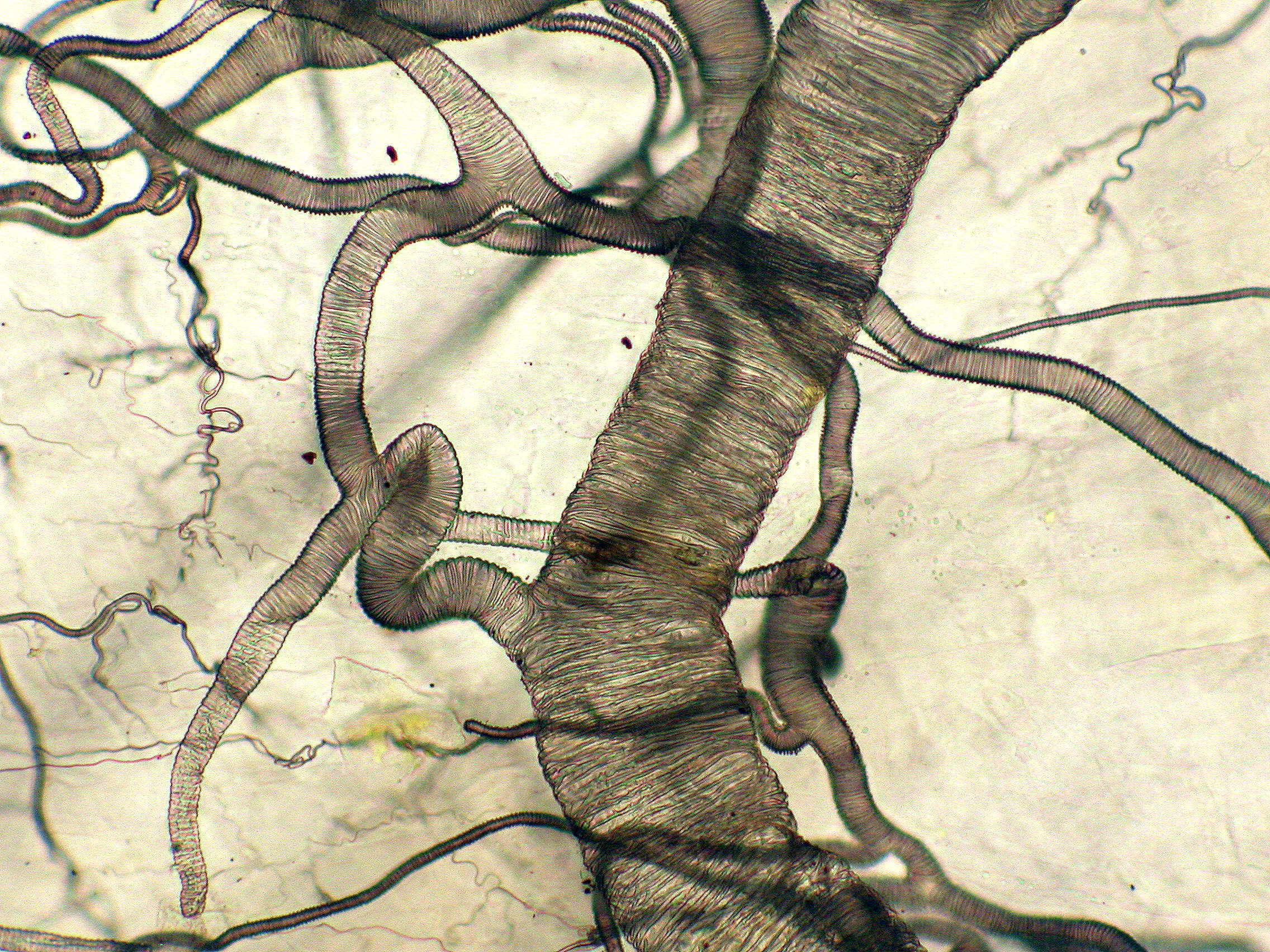 Tracheoles (respiratory tubes) of Apis mellifera (bee) | Nikon Small World