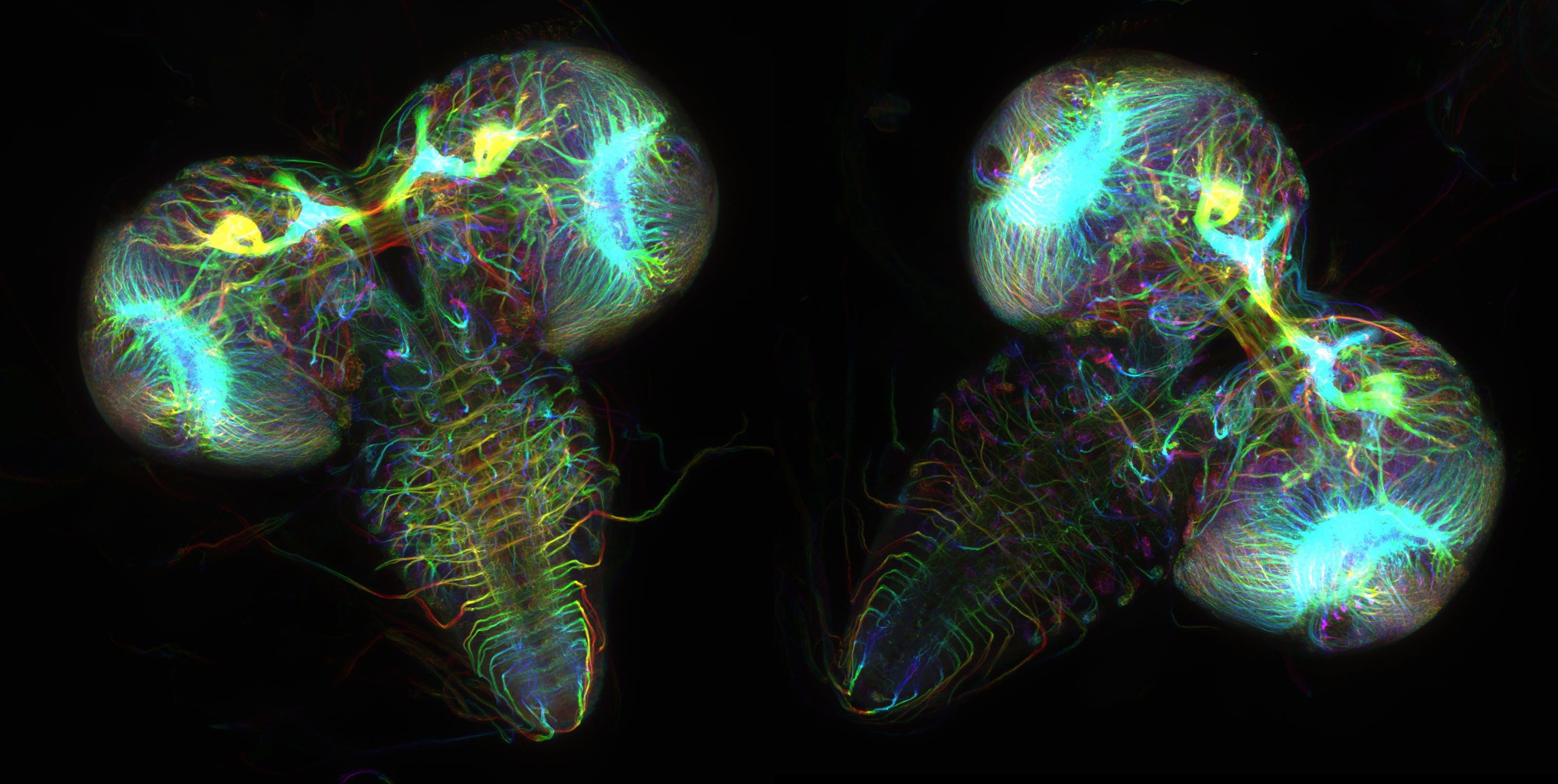 Drosophila Melanogaster (fruit Fly) Larval Brains | Nikon’s Small World