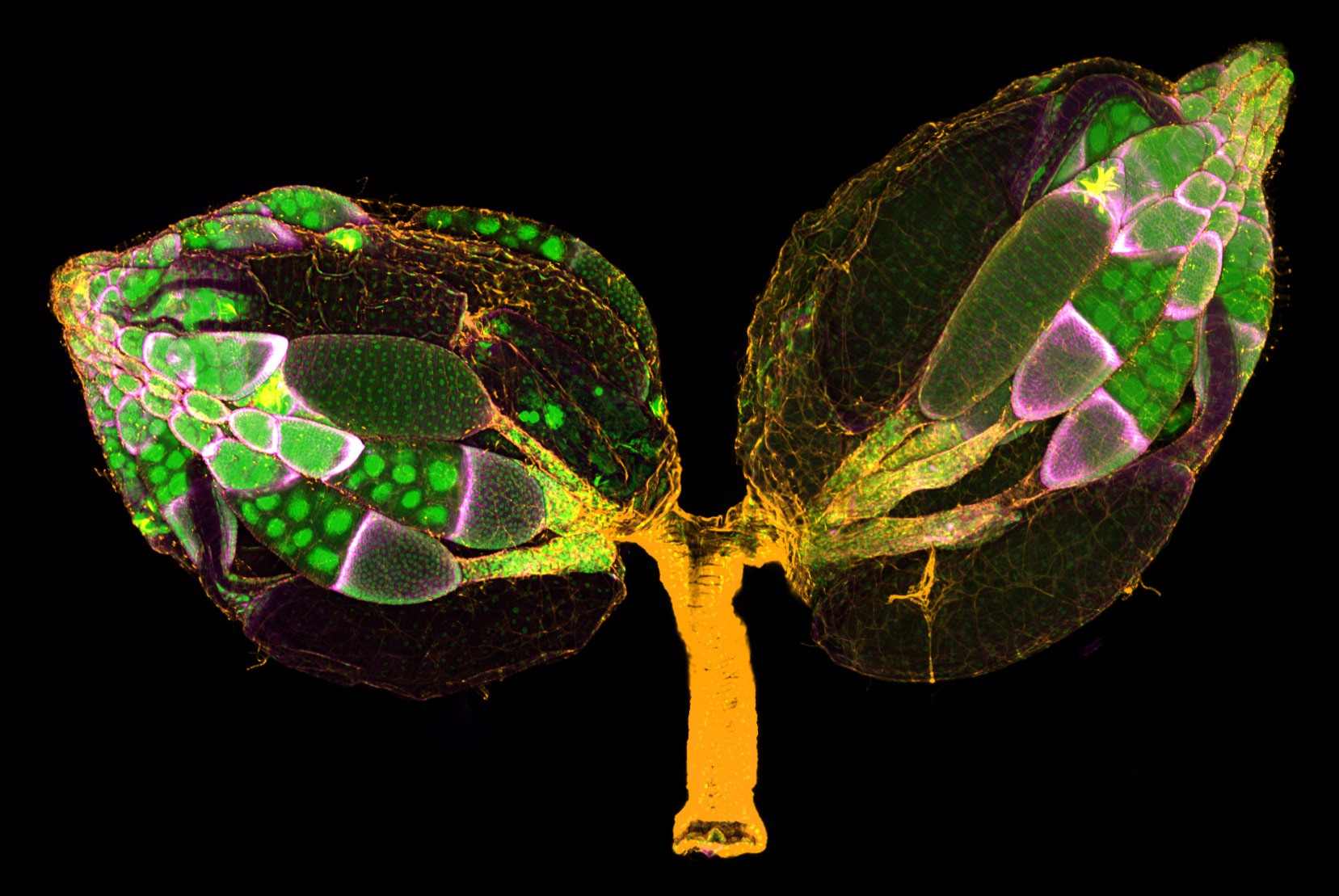 a-pair-of-ovaries-from-an-adult-drosophila-female-nikon-s-small-world