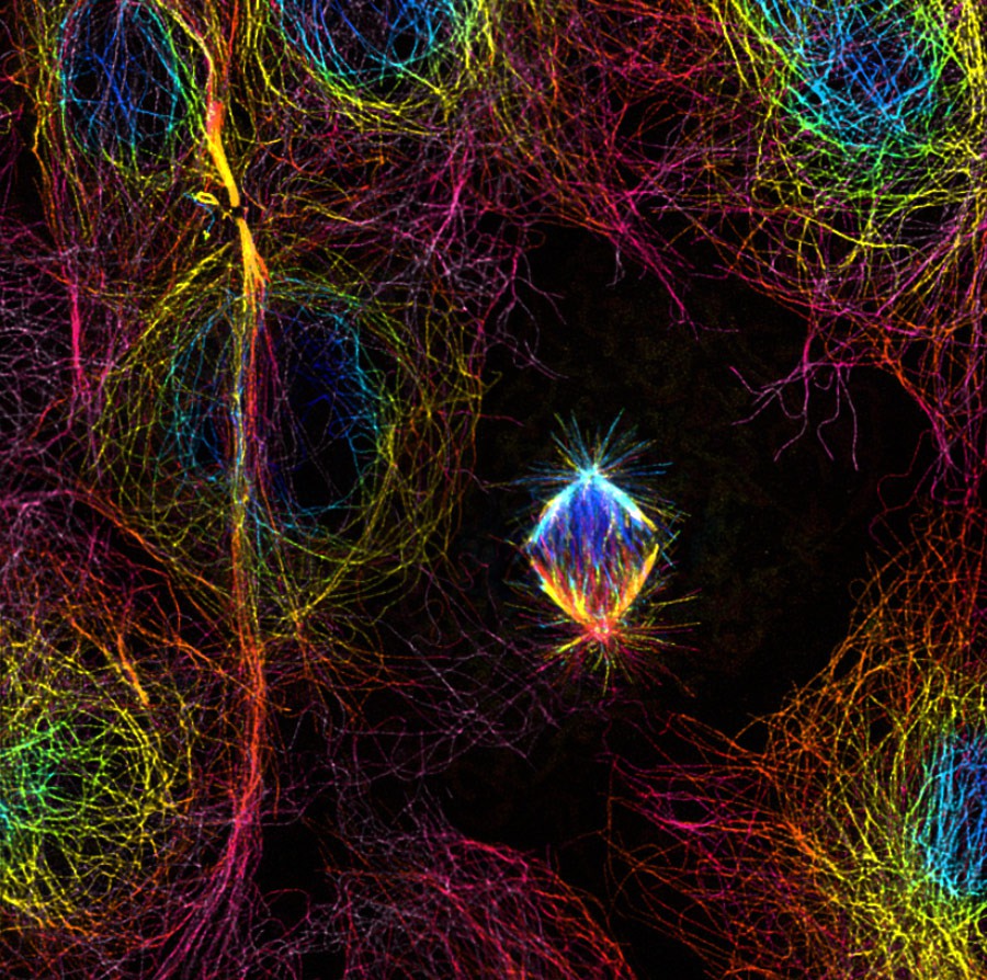 Microtubules in dividing monkey kidney tissue cell | Nikon’s Small World