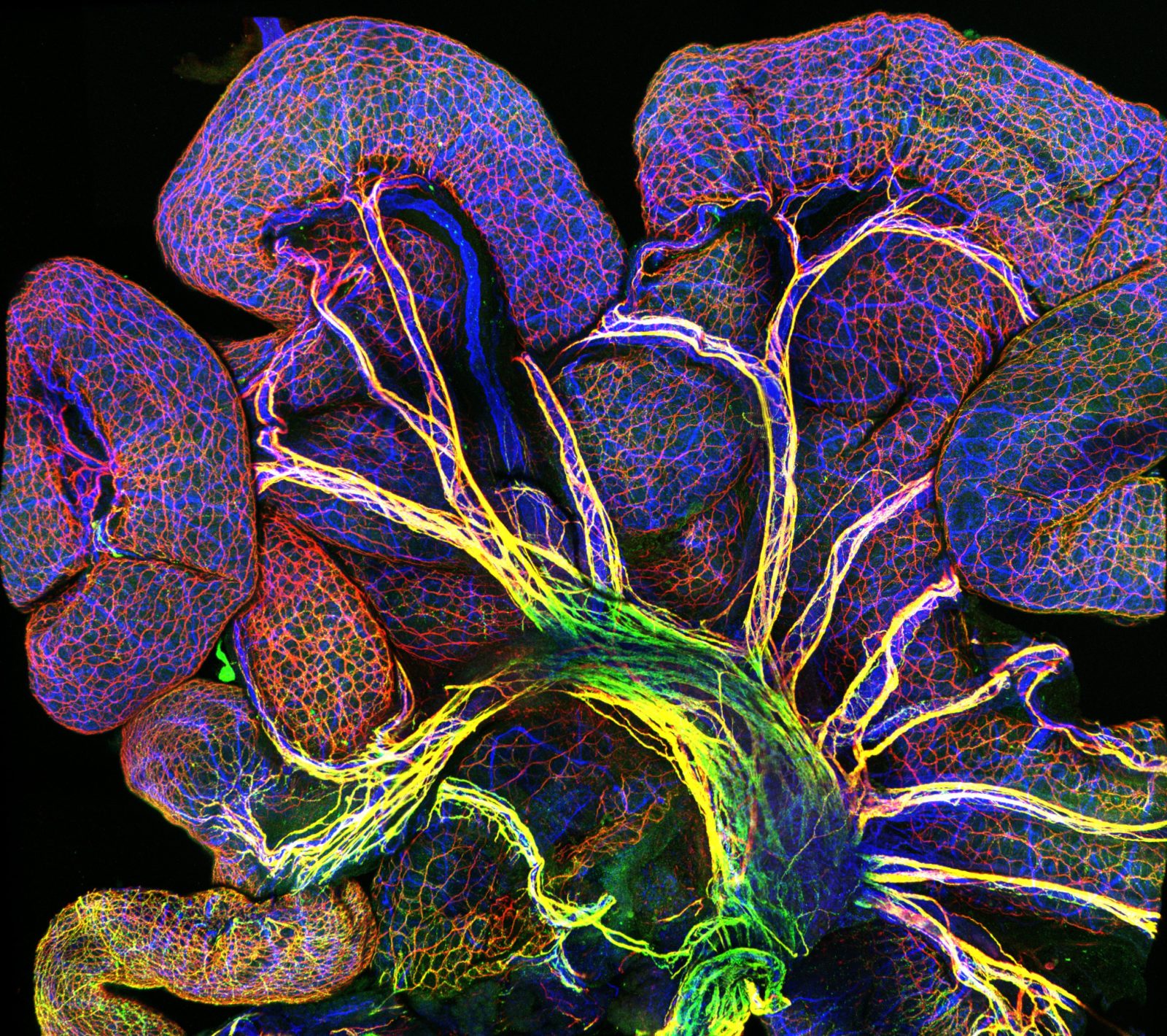 Endothelial cells in intestine of an 18.5-day old mouse embryo | Nikon ...