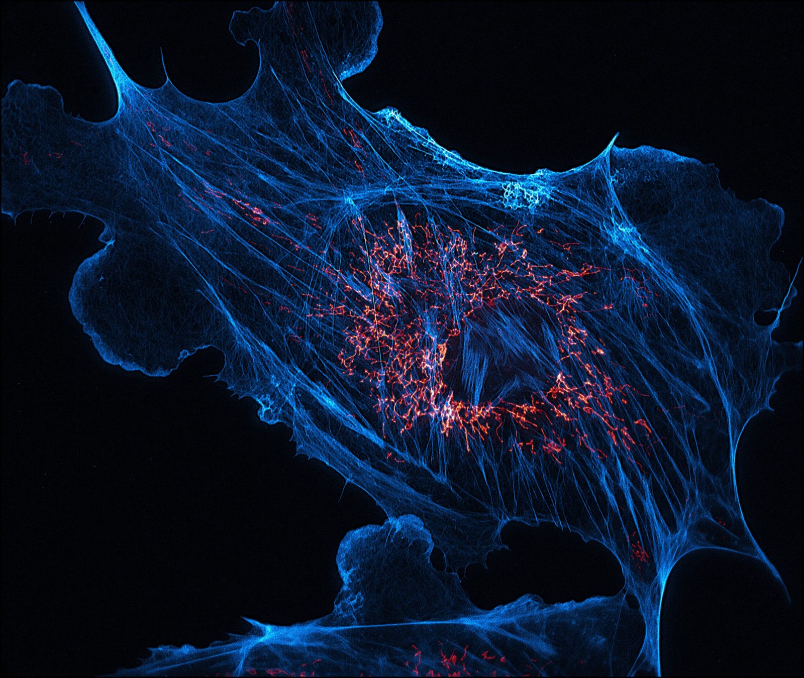 Флуоресцентная микрофотография митохондрии