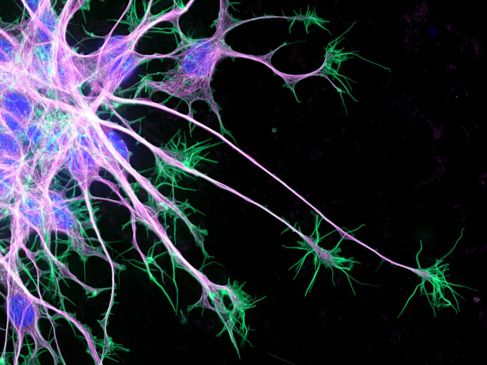 Neuron growth (actin in green; microtubules in purple; nuclei in blue) 2019...