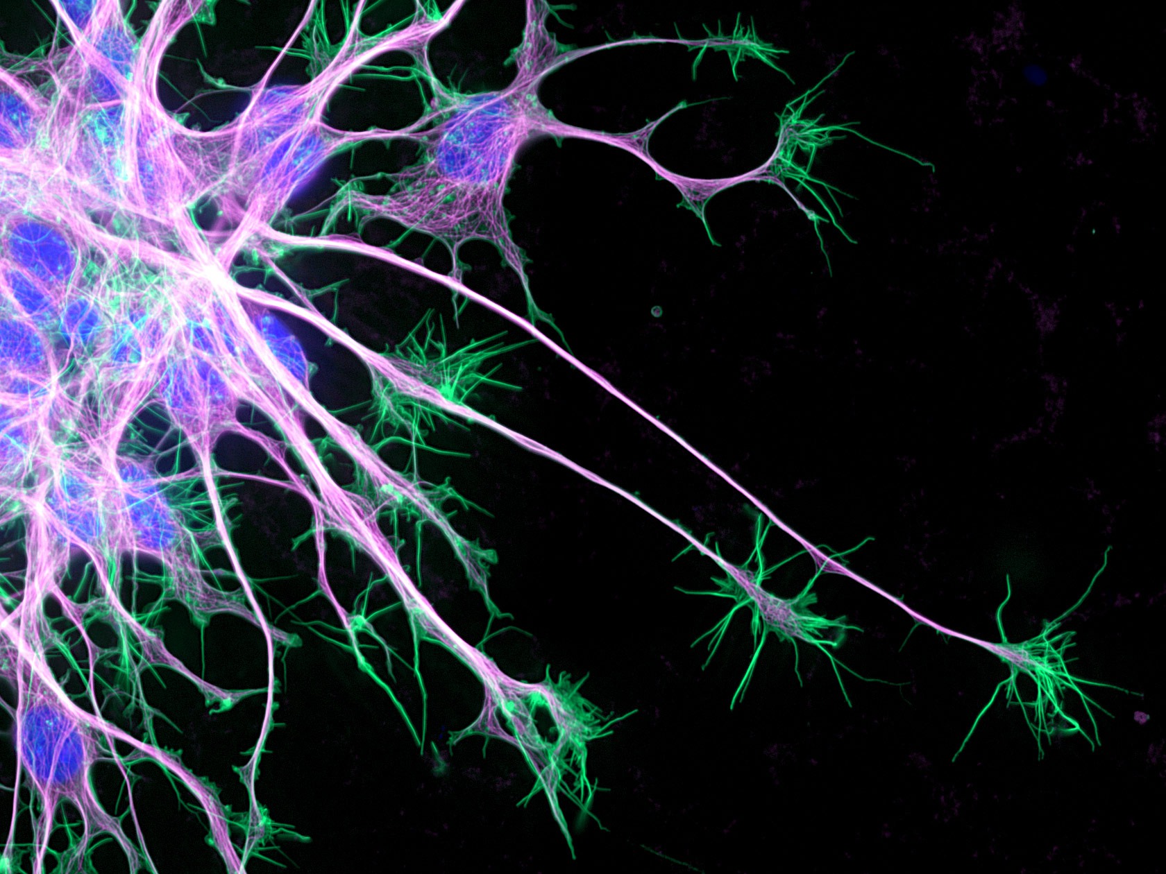 Neuron growth (actin in green; microtubules in purple; nuclei in blue ...