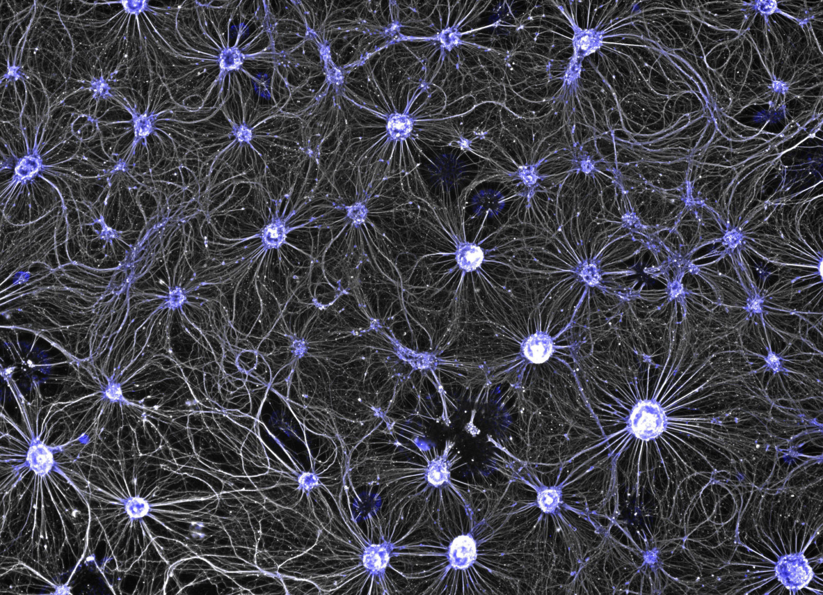 Motor neurons derived from human induced pluripotent stem cells 2020 Photom...