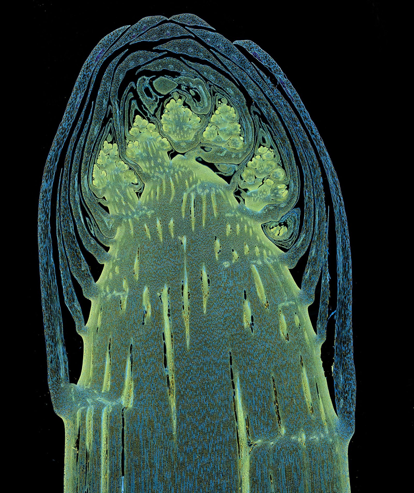  Longitudinal section through a white asparagus shoot tip