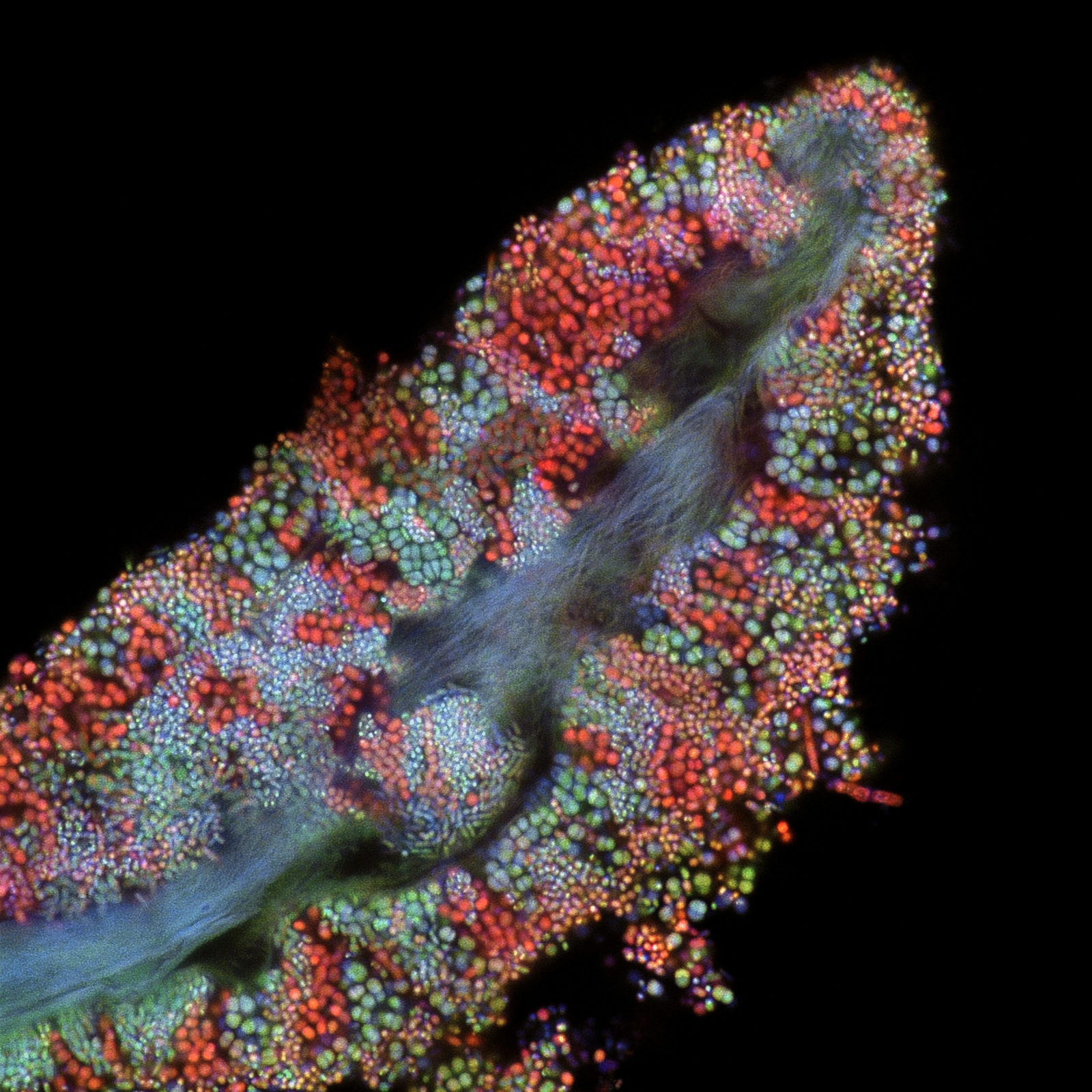 Bacterial biofilm on a human tongue cell