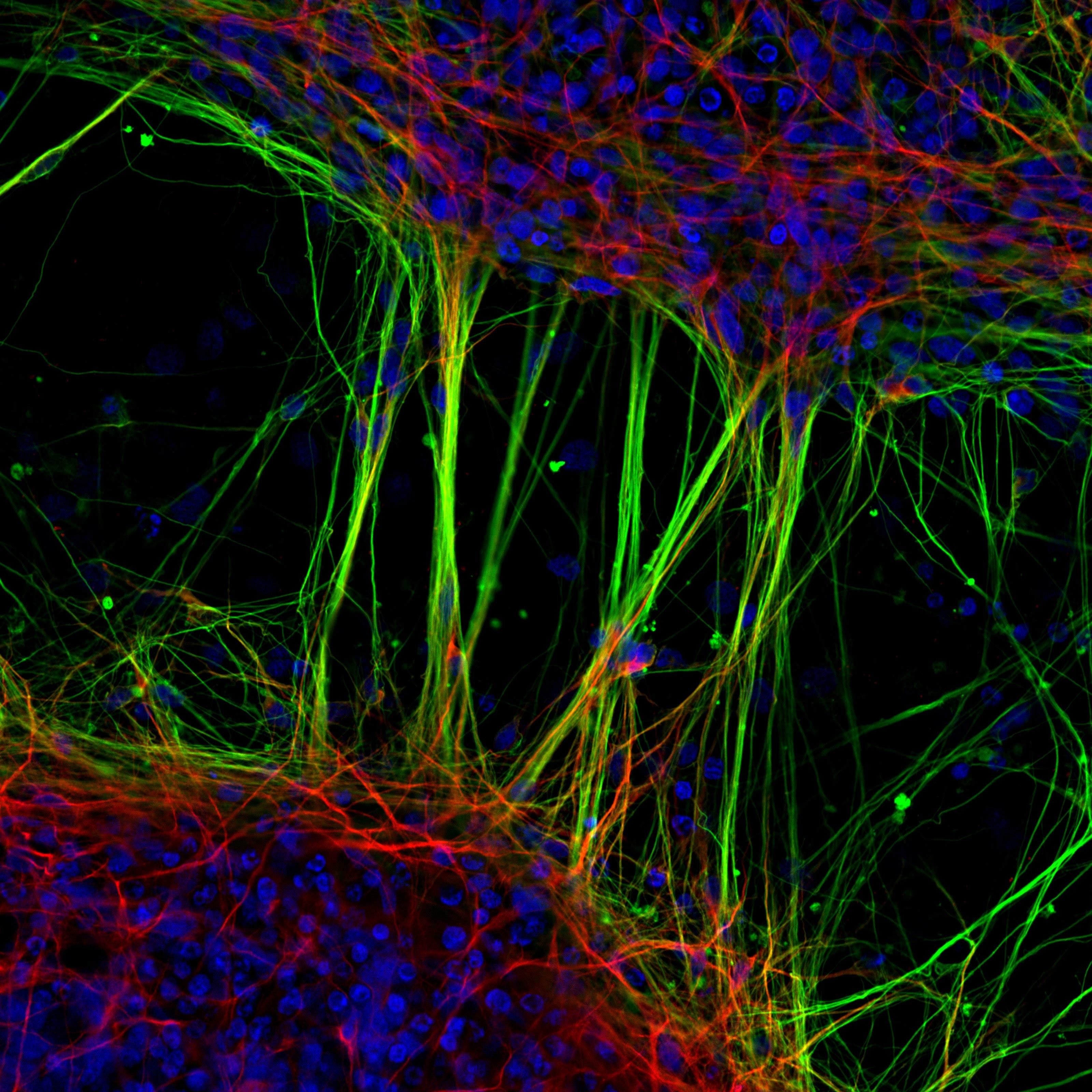 Do Human Neurons Have Cytoplasm